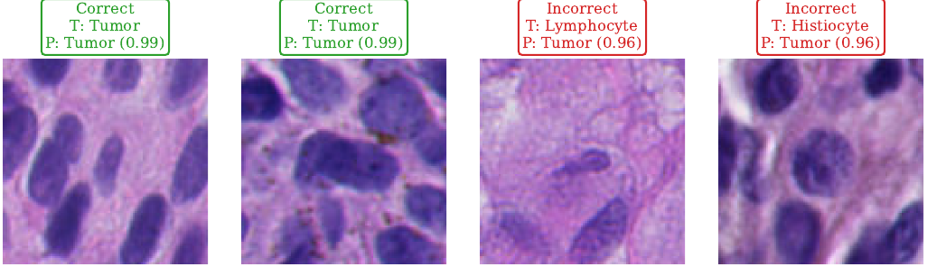 Correct and incorrect EfficientNet nuclei classifications